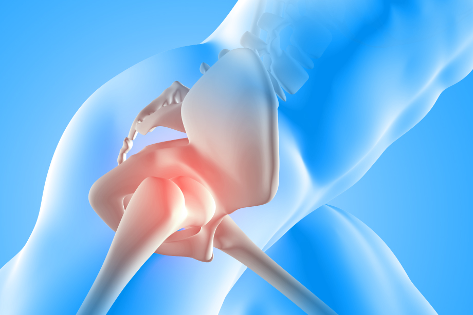 HIP-JOINT-REPLACEMENT-IN-CANCUN-AND-ITS-BENEFITS